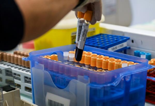 Le réseau de laboratoires de biologie médicale Cerballiance en France a annoncé vendredi avoir été victime fin mars d'une attaque informatique ayant entraîné "un accès non autorisé" à des données personnelles de "certains de ses patients"