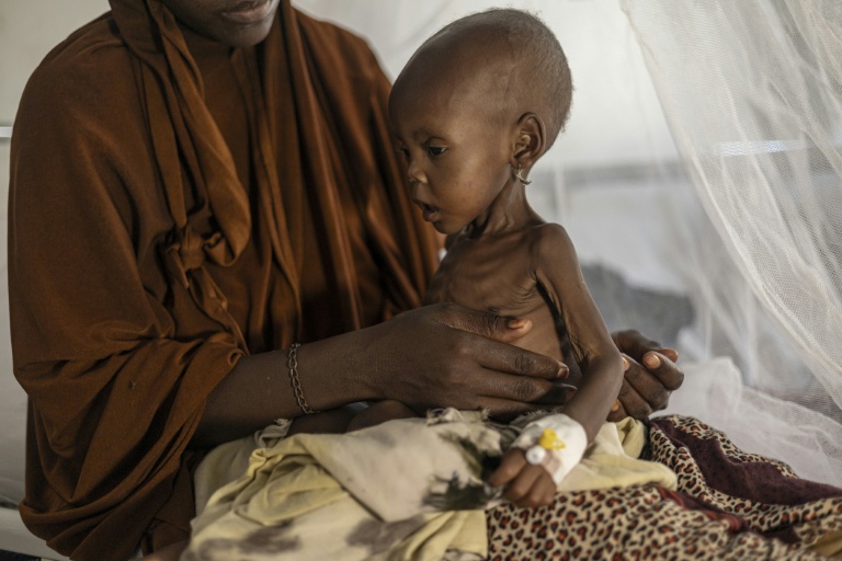 Une Somalienne récemment déplacée tient dans ses bras son bébé souffrant de malnutrition sévère dans un centre de santé, à Kismayo, le 22 avril 2026 