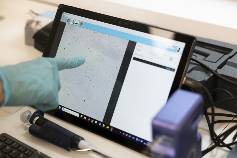 Les spermatozoïdes de la panthère mâle Baruto vus au microscope, lors du prélèvement de semence, le 9 octobre 2025 au zoo de Mulhouse, dans le Haut-Rhin