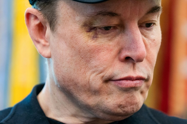 L'homme d'affaires et ex-conseiller du président américain Donald Trump, Elon Musk, avec un oeil au beurre noir lors d'une conférence de presse à la Maison Blanche, à Washington, aux Etats-Unis, le 30 mai 2025