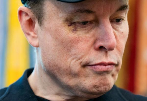 L'homme d'affaires et ex-conseiller du président américain Donald Trump, Elon Musk, avec un oeil au beurre noir lors d'une conférence de presse à la Maison Blanche, à Washington, aux Etats-Unis, le 30 mai 2025
