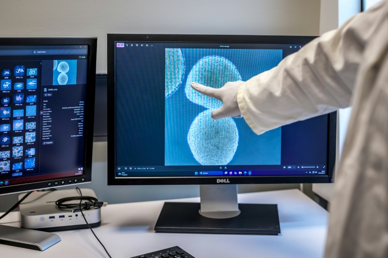Des cellules cérébrales humaines sur un écran à la start-up FinalSpark, le 3 octobre 2025 à Vevey, en Suisse
